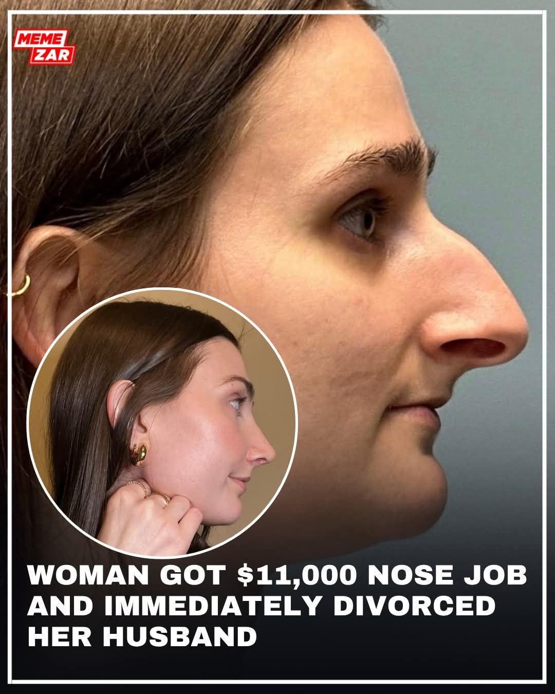 Buy why would she change her nose?