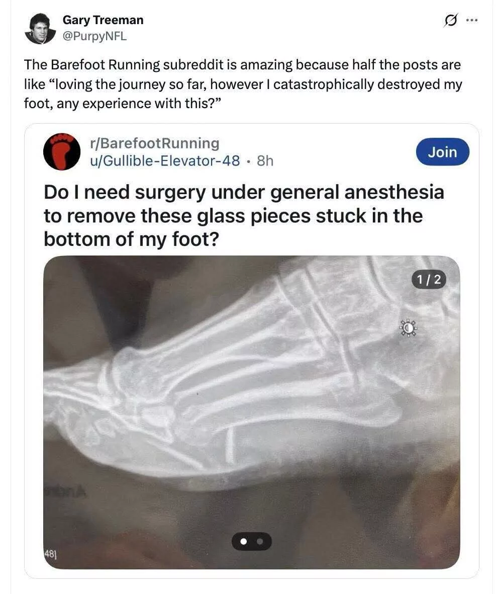 nah just leave them there