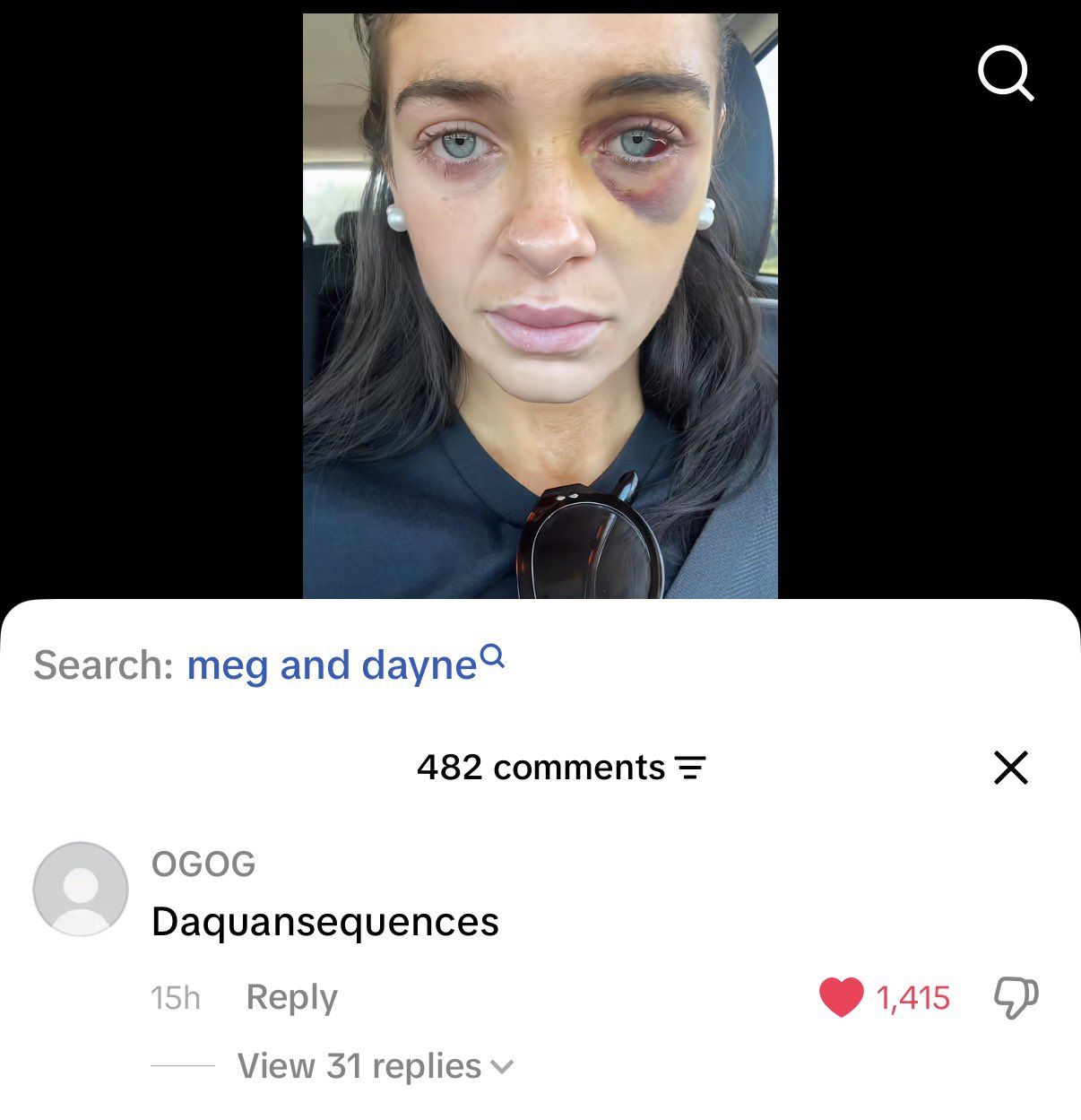 lol