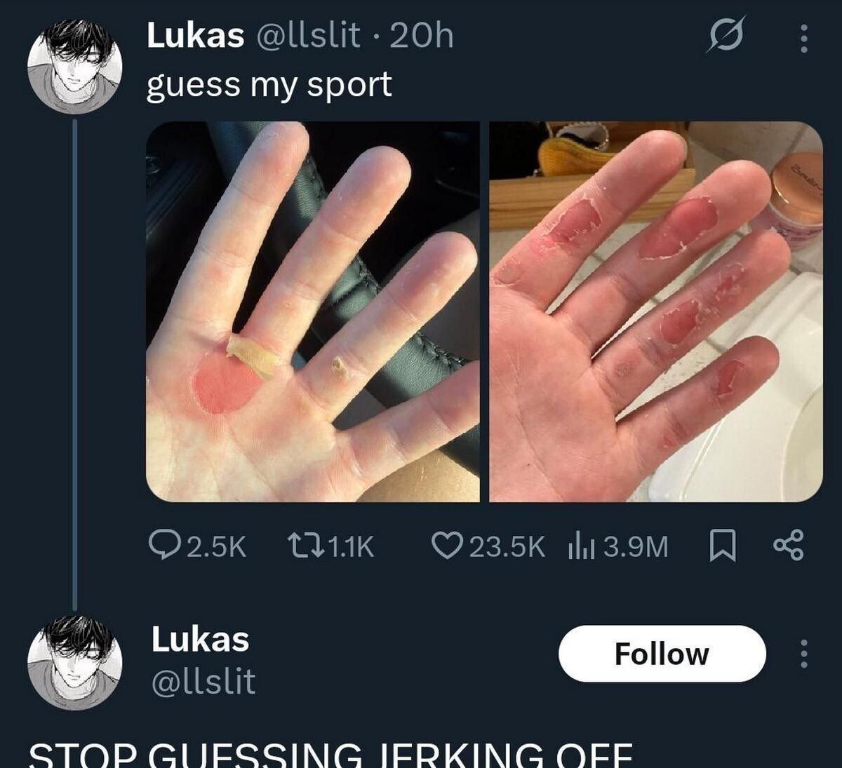 Werkeling the Willy?