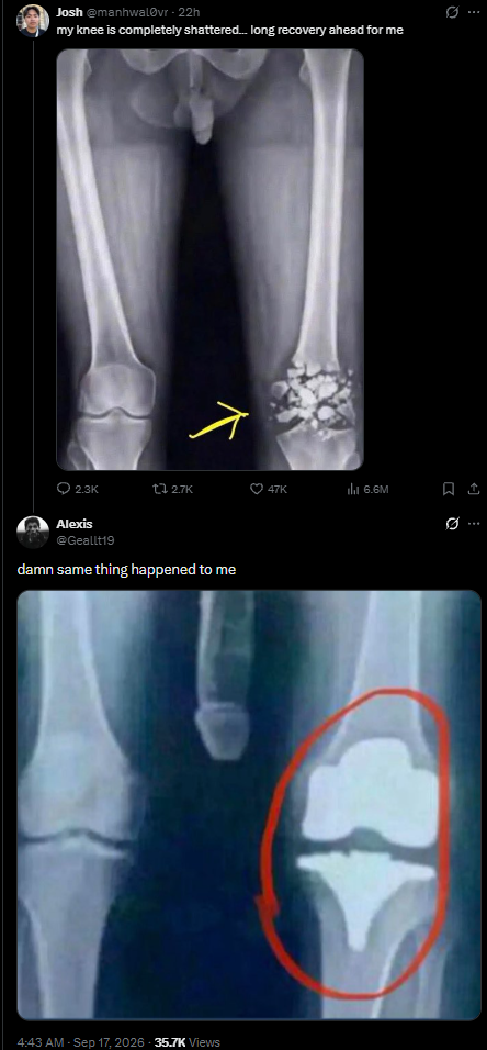***