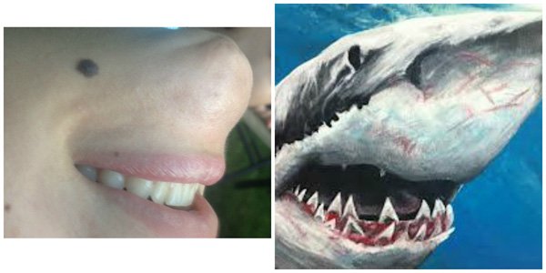 The chin of my friend looks like a shark