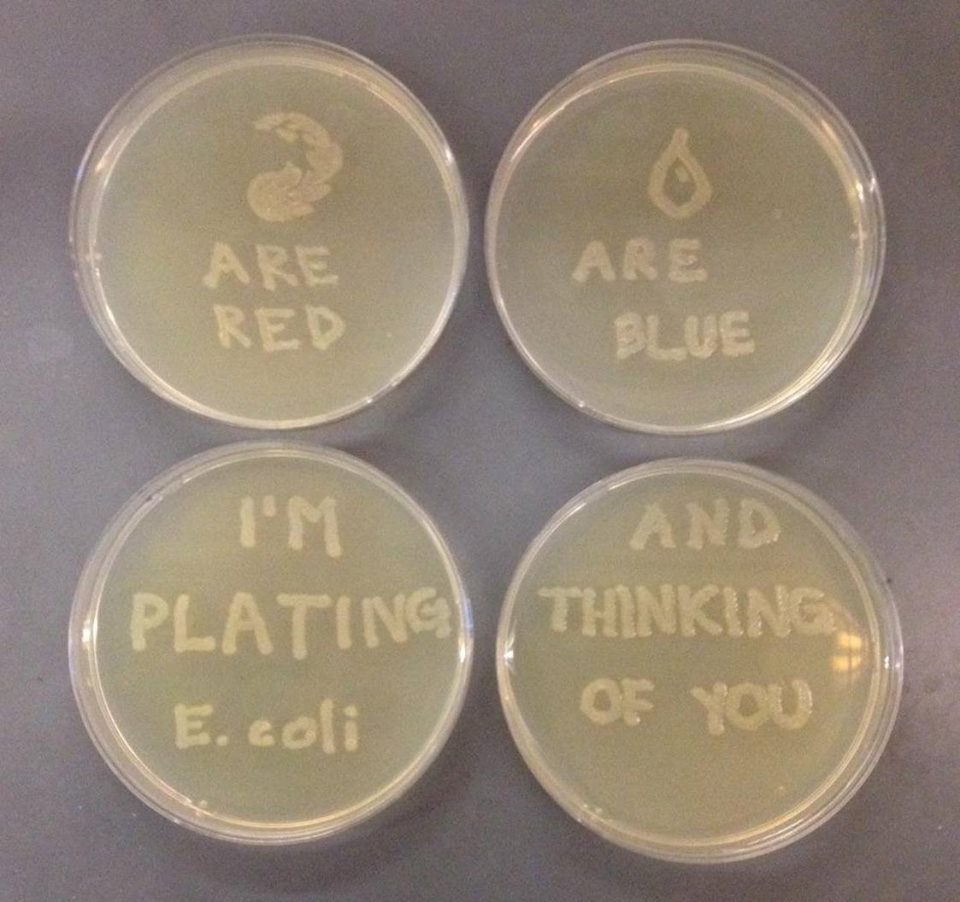 E. Coli reminds me of you <3