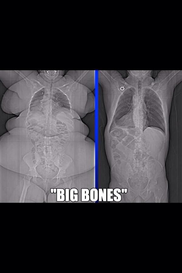 "I'm not fat I have big bones"...
