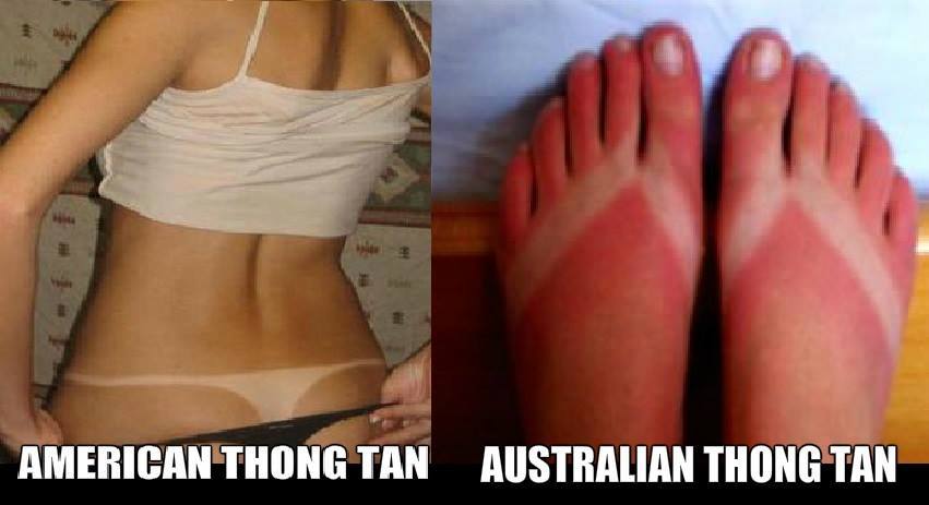 Tan issues