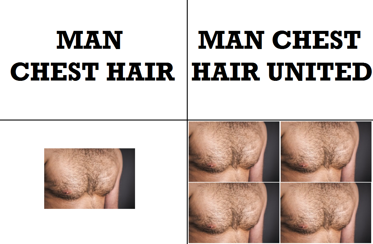 Get it? Get it? Because there are multiple pictures of man chest hair!