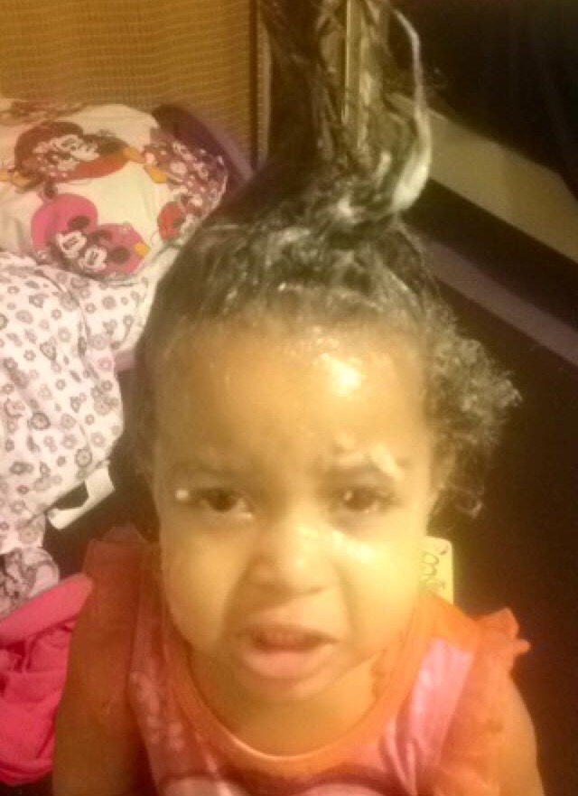 When your 2 year old decides to put half a container of Vaseline in their hair.