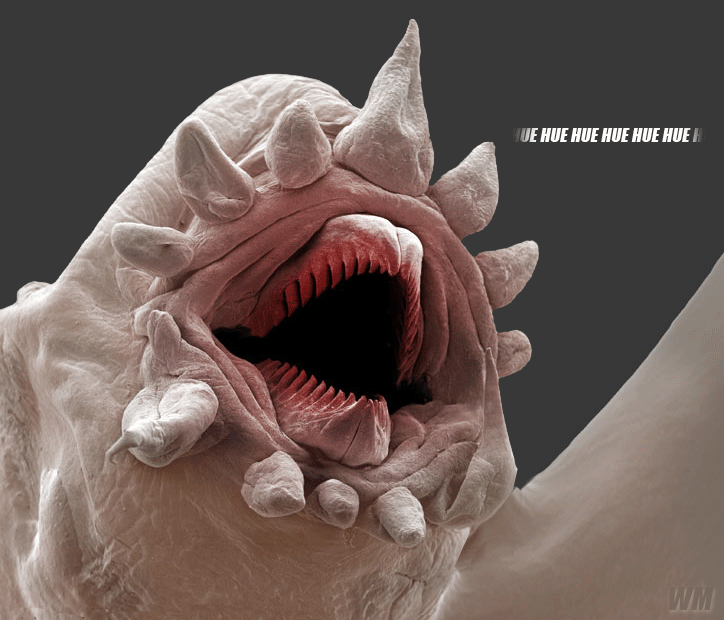 When people try to kill the bacteria but you're really a parasitic polychaete