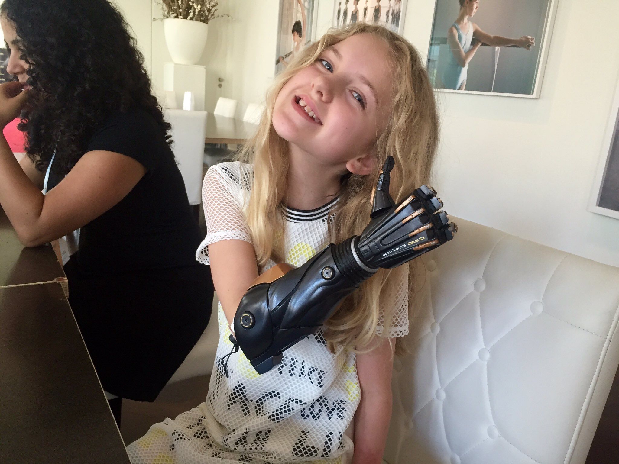 A girl with a bionic arm