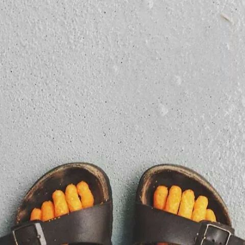 These are the toes of a 12yo girl suffering 3rd-degree burns. One upvote = one prayer.
