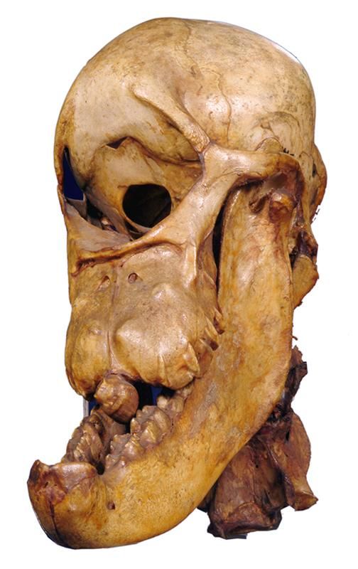 skull of a horse with cyclopia from 1841