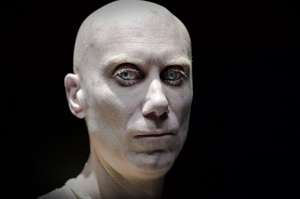Stephen Merchant as the mutant Caliban in 'Logan'