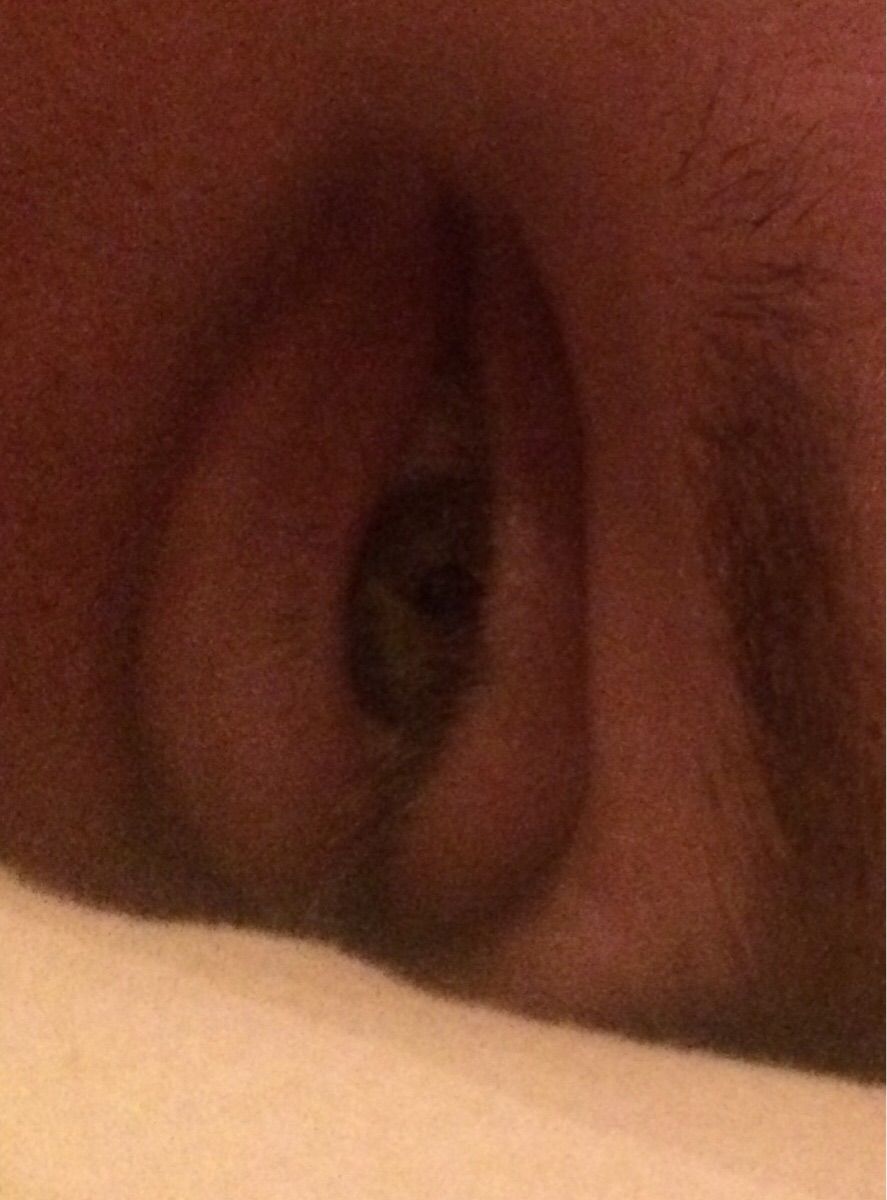 I told my husband that when he gets tired his eyes turn into eye vaginas, he didn't believe me so I took a pic and rotated it