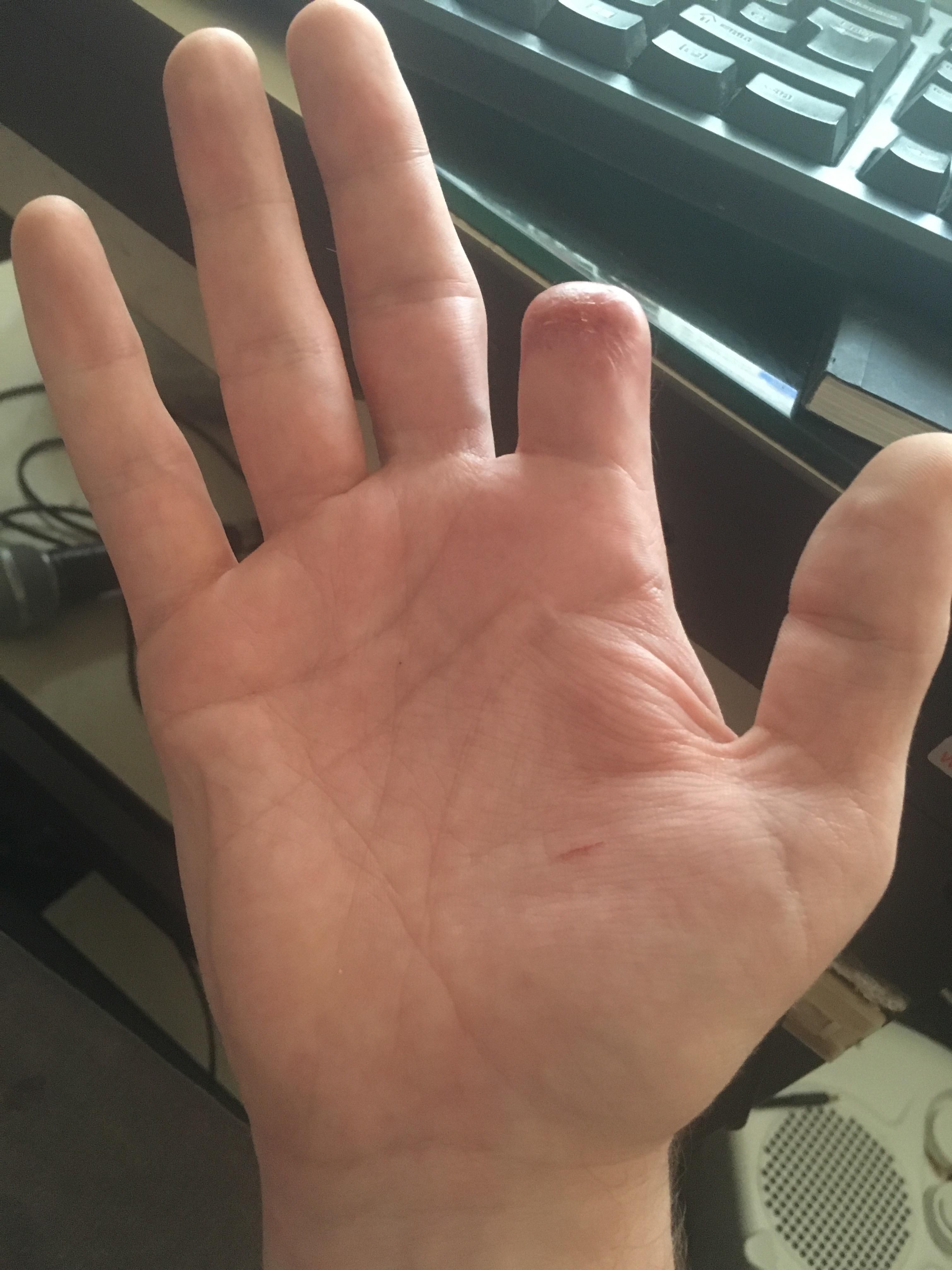 This is my hand, there's a joke in here somewhere... but I can't put my finger on it.