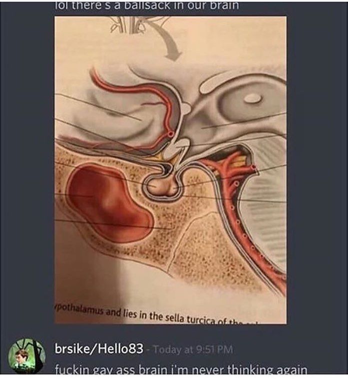 no homo