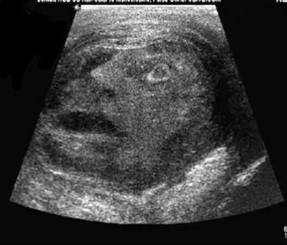 Revolver0celot's ultrasound pictures