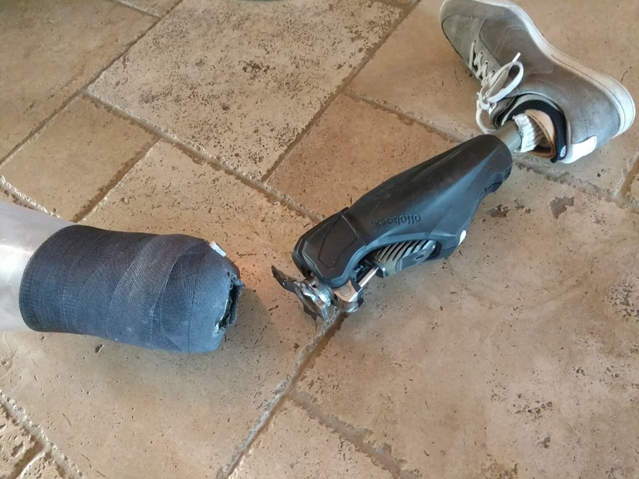 My uncle broke his leg today. He said it didn't even hurt.