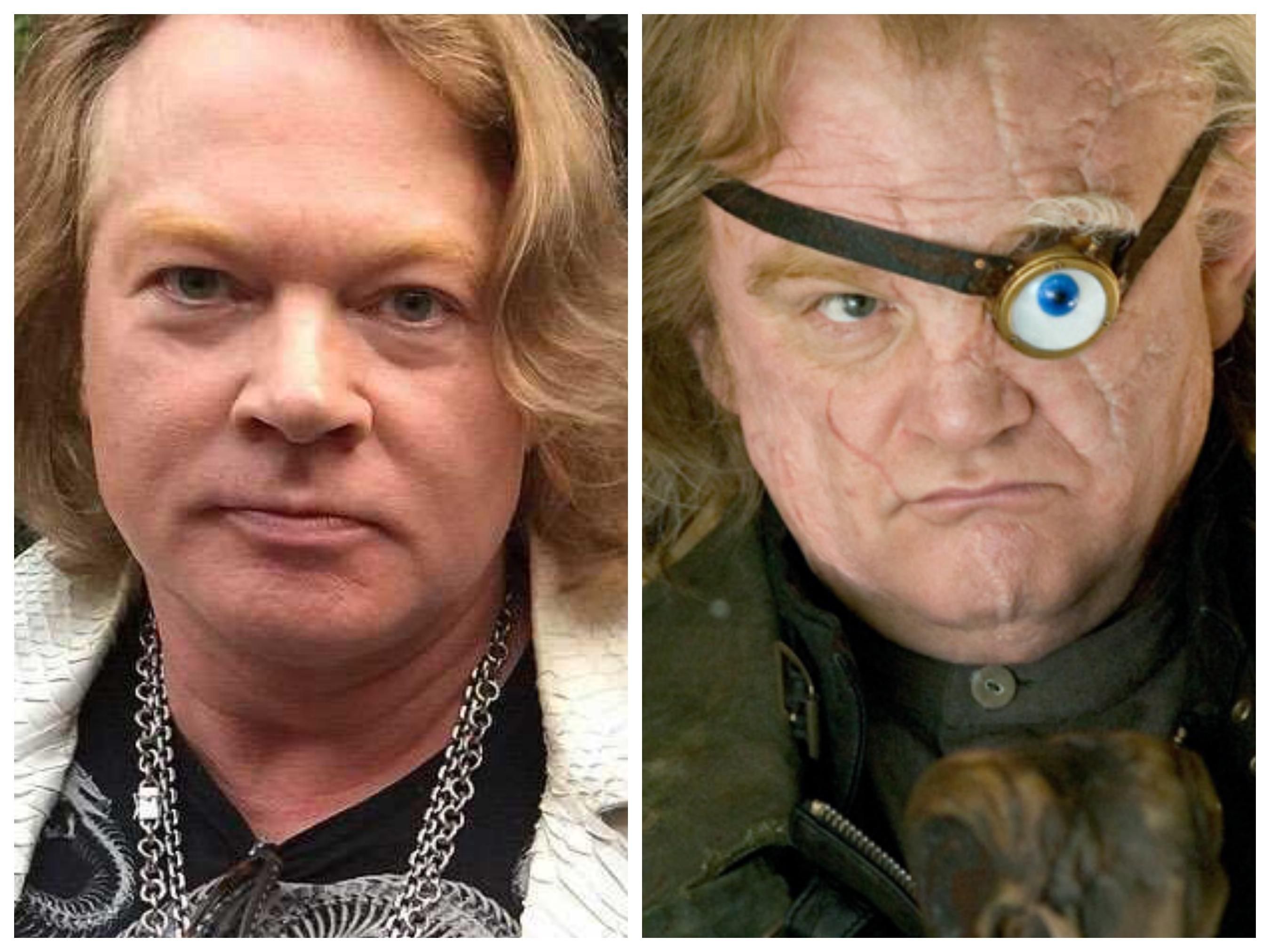 Axle Rose has become Alastor Moody!