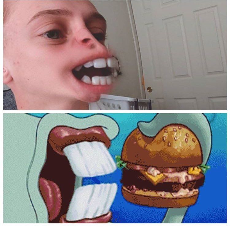 whats wrong with the kids nose tho
