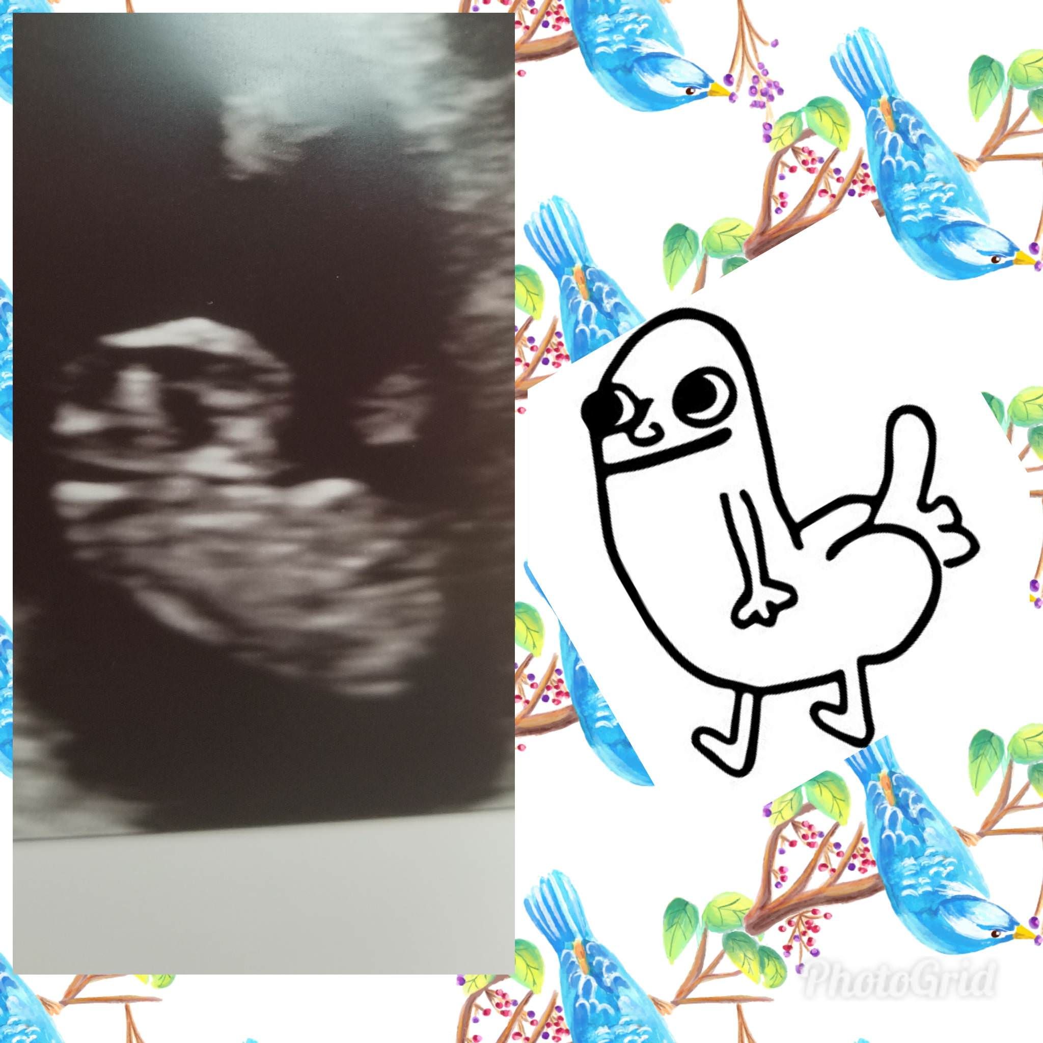 I think I'm pregnant with dickbutt