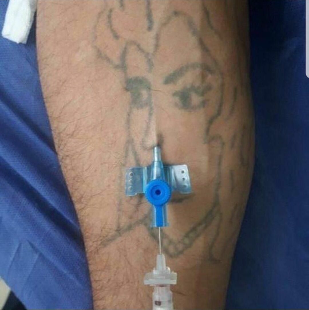 What happens when you give an ENT doctor an IV cannula