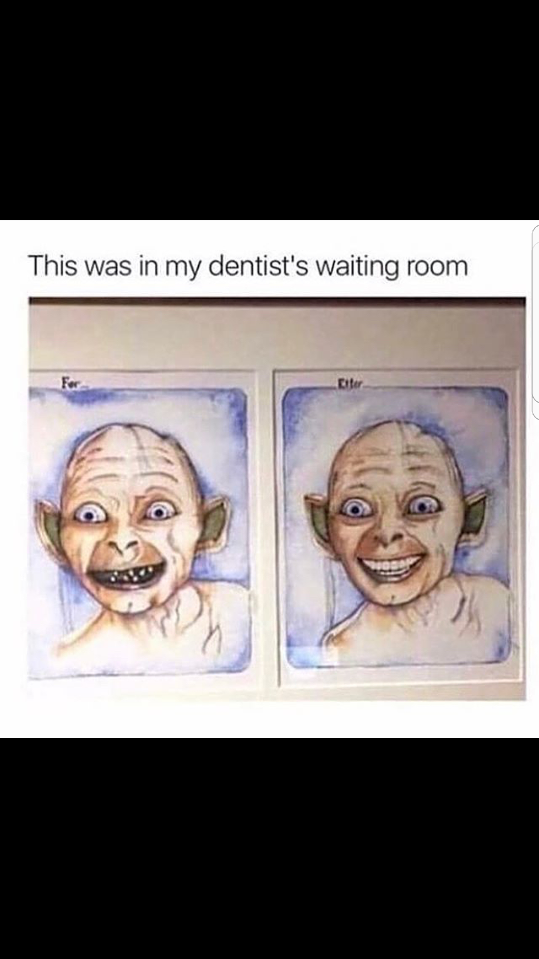 I went to the dentist, and...