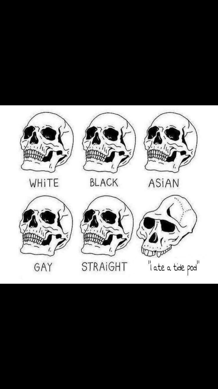 We are all the same underneath. Except some...