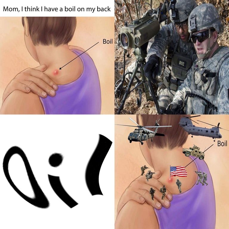 OIL!!