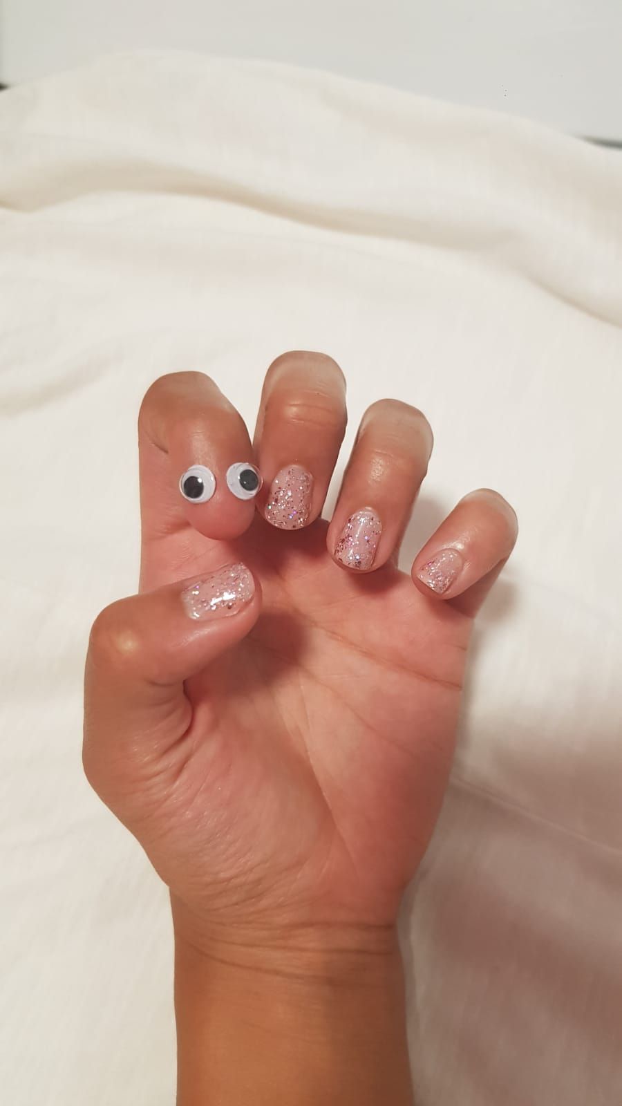 My GF was born without a nail on a finger. So due to popular demand, we put google eyes on it!