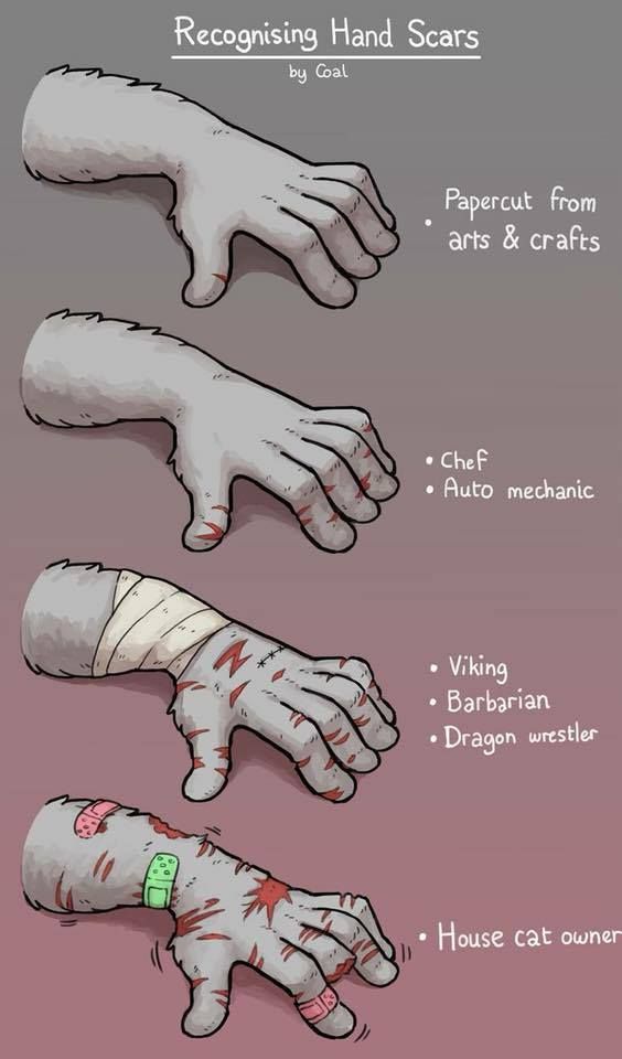 ~~ Recognizing Hand Scars ~~