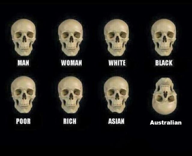 Welcome to the land down under