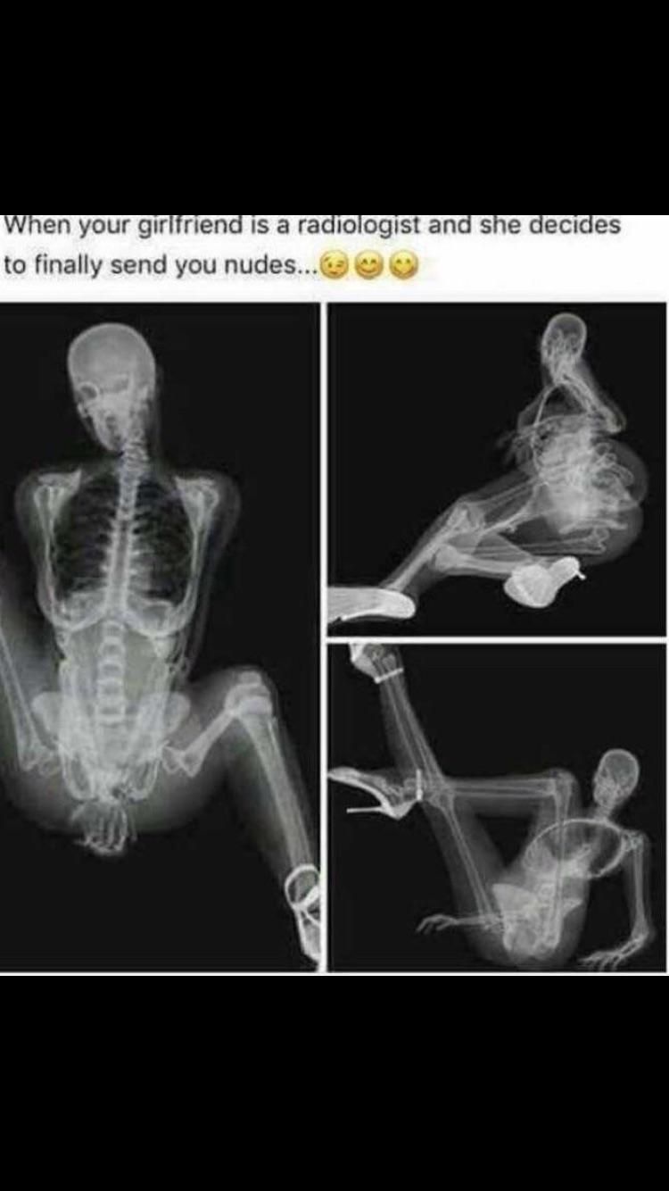 Рентгенолог Мем