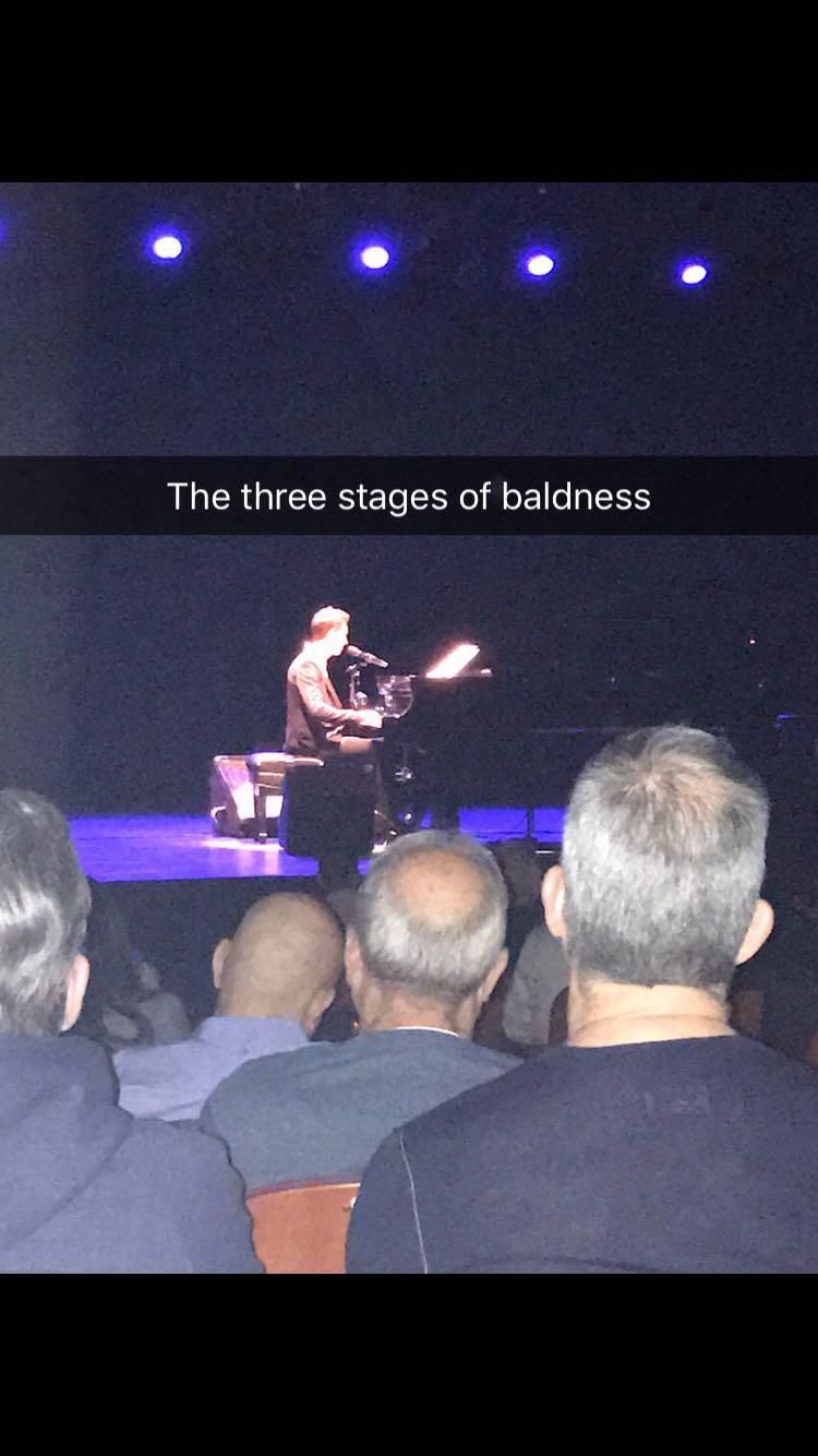 Three stages of baldness.