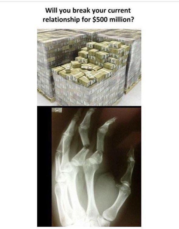 I can get new hand for that money anyway