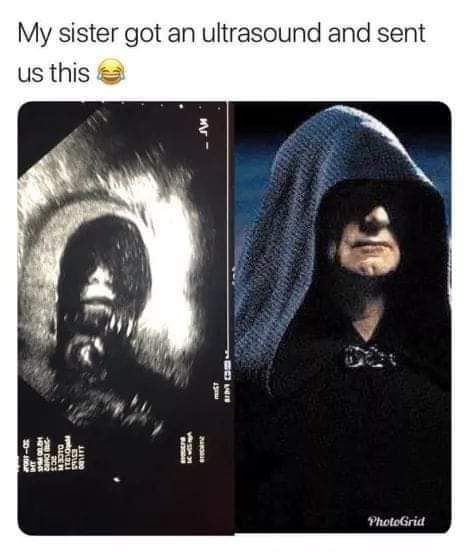 Would you like to know the gender of the baby...Yes sure...Sith Lord...Excuse me?...Boy, it's a boy.