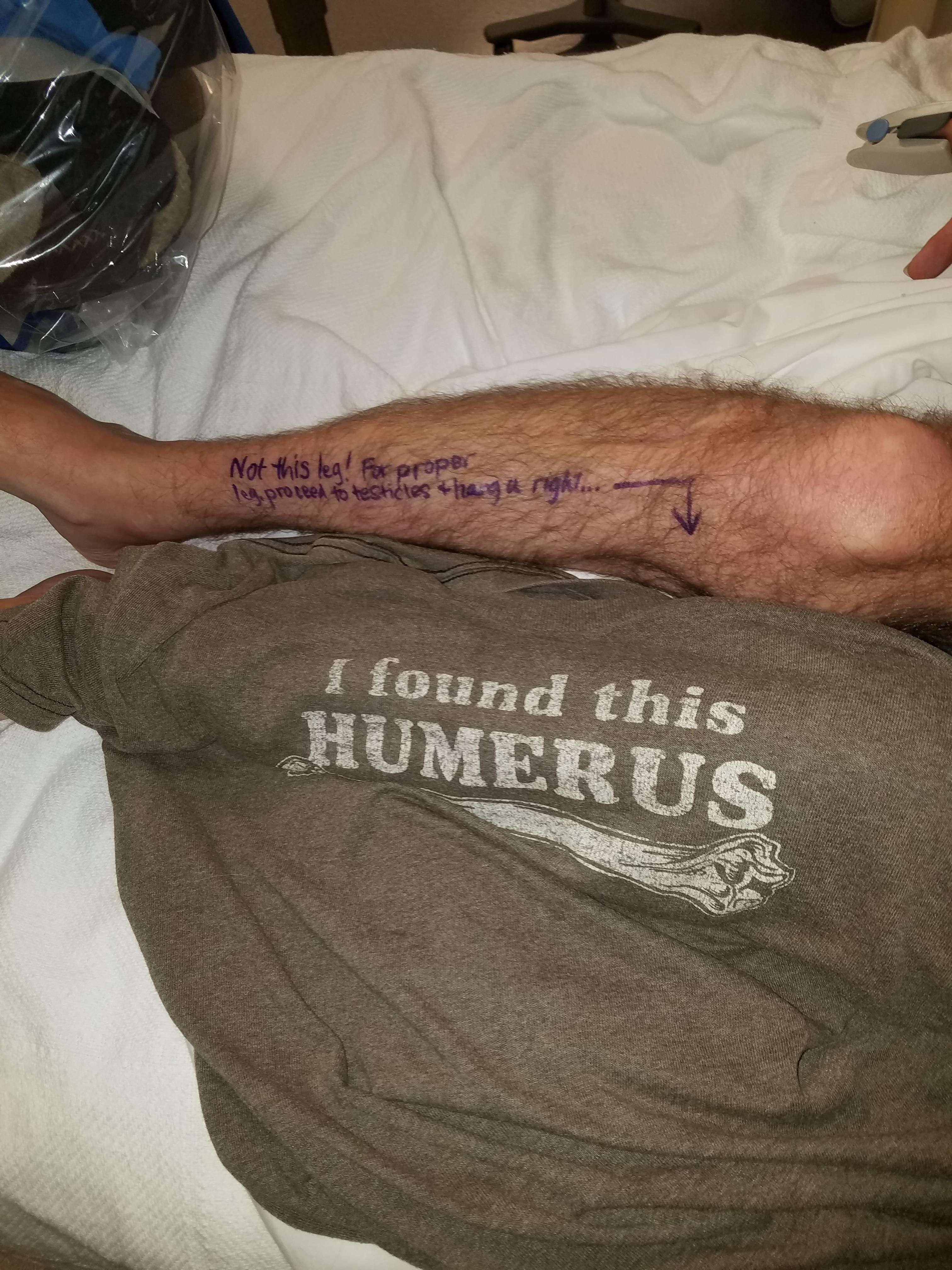 I'm having my left leg amputated today. I wore this shirt and wrote this on my leg for the surgeons. If I couldn't laugh about it...
