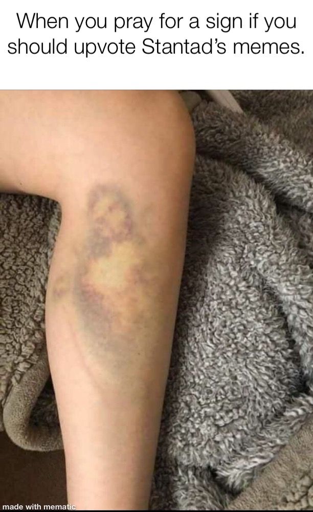 Why does this bruise look like Jesus?