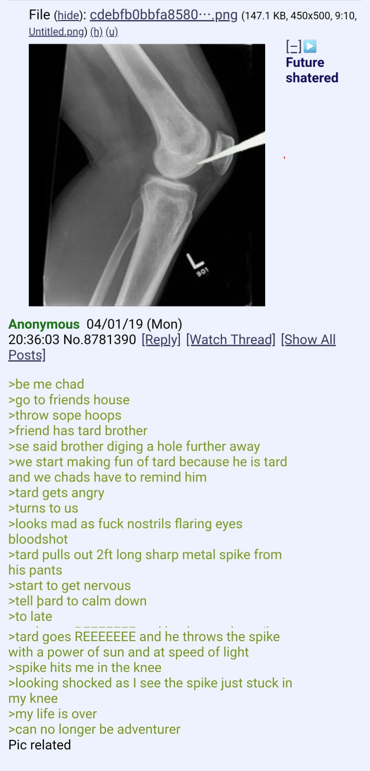 Anon the chad