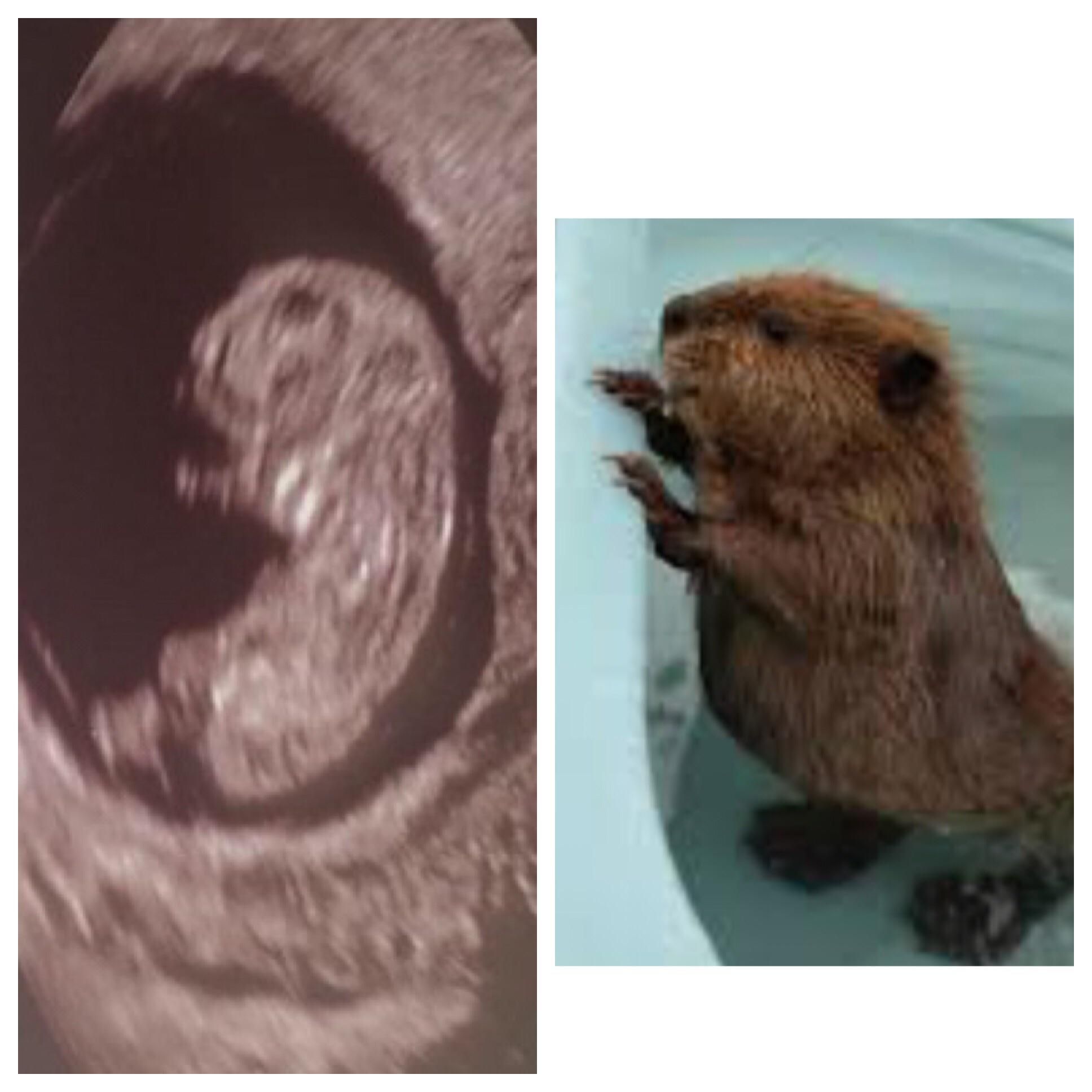 My sister’s baby sonogram reminds me of a beaver