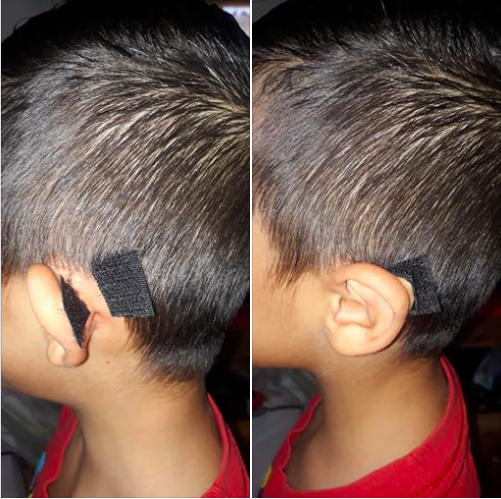 Fashion tip for my large-ear bretheren