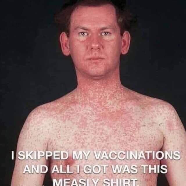 The real downside of being an antivaxxer.