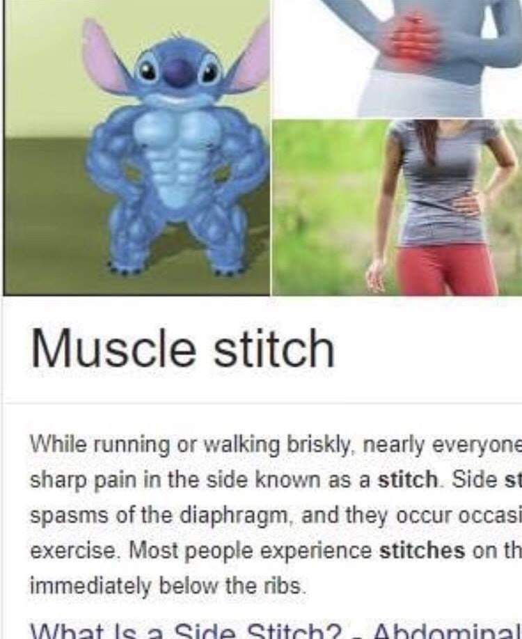 What is muscle stitch?