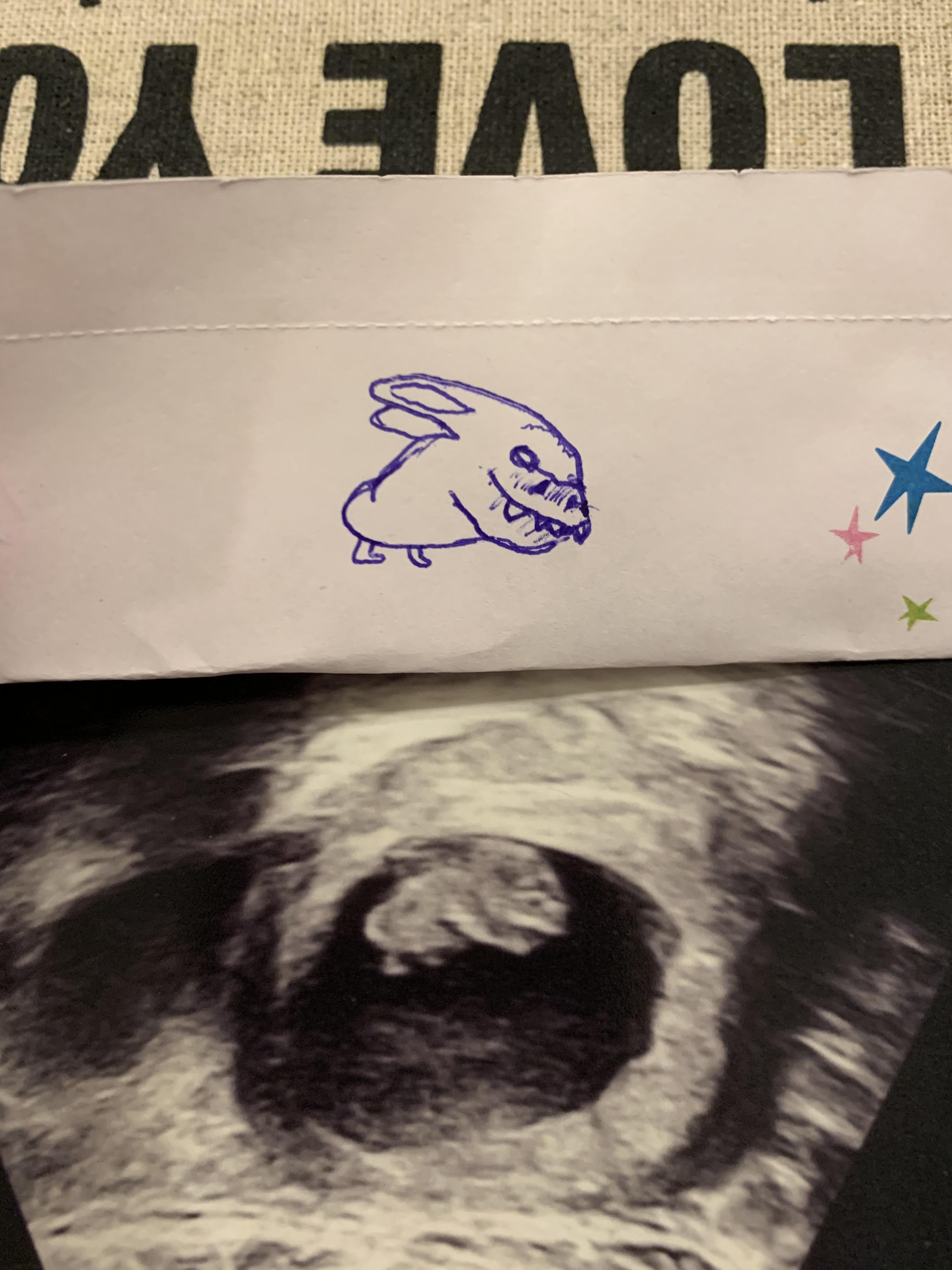 I found out I’m going to be an uncle!!! My sister wasn’t too happy about my interpretation of her upside down ultrasound.