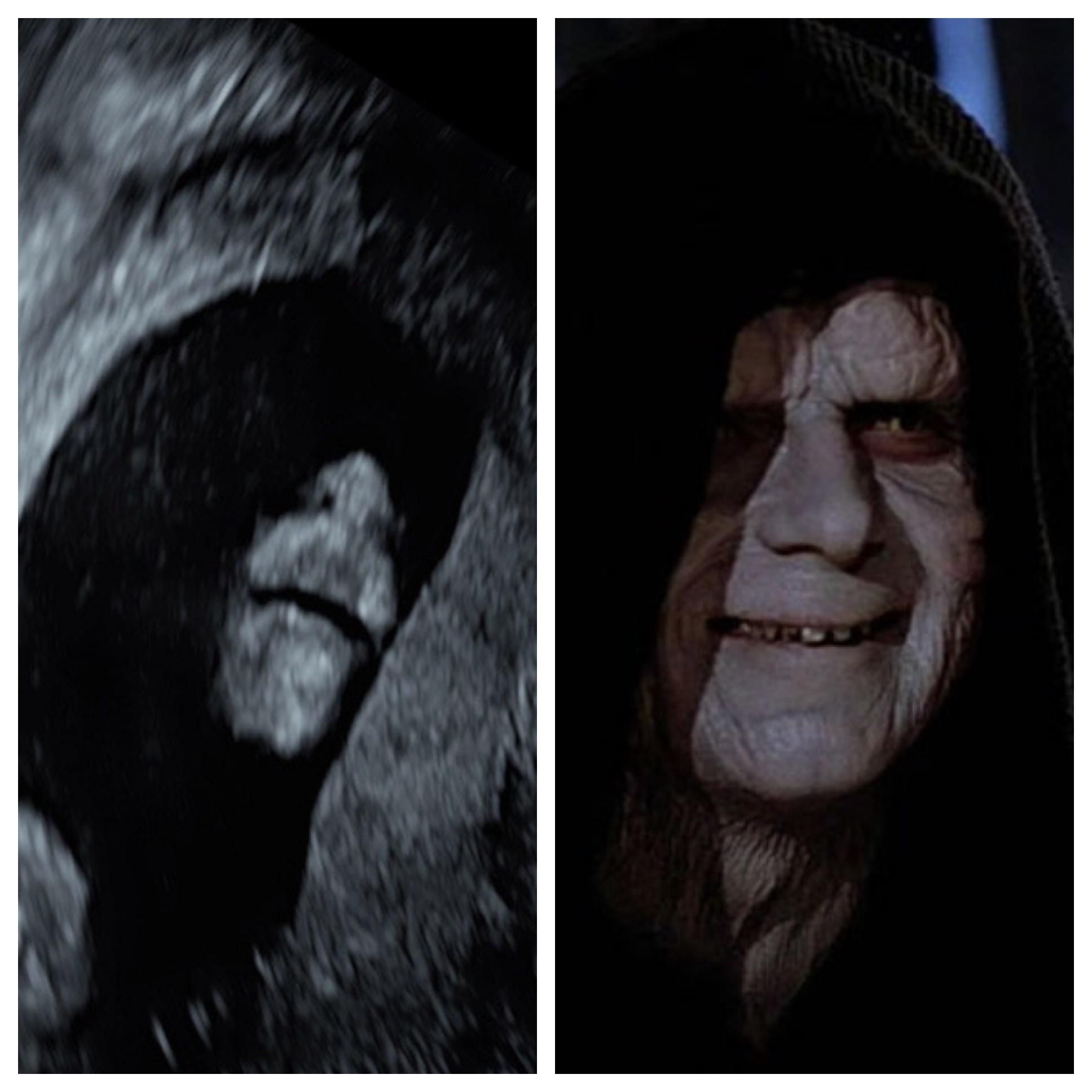 My baby’s ultrasound or Darth kidious
