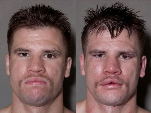Boxer before and after a fight