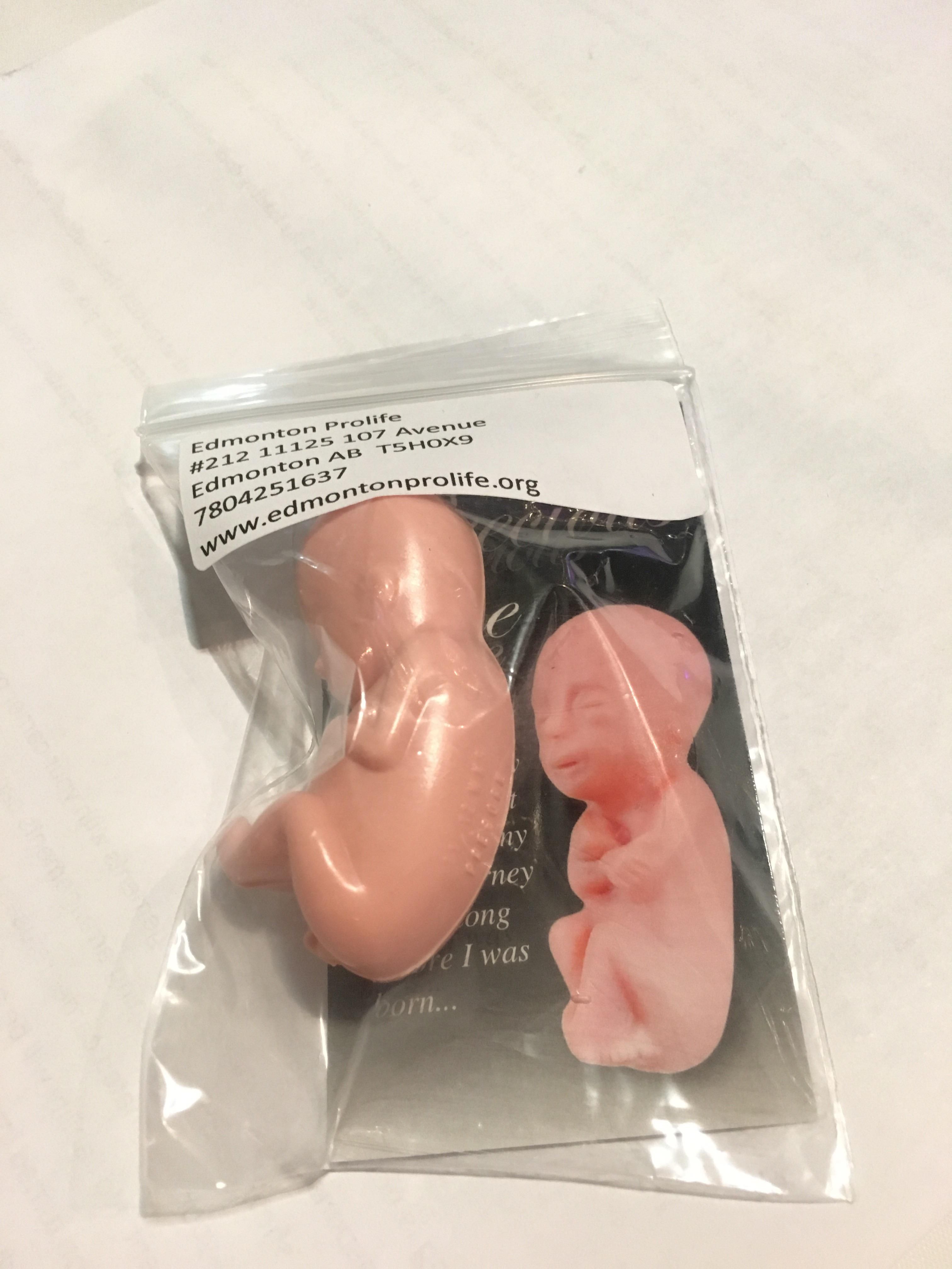 A pro-life table at a teacher’s convention is giving away fetus erasers. This is the true height of irony.