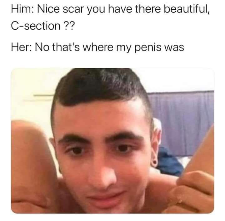 Shoulda ate the ass