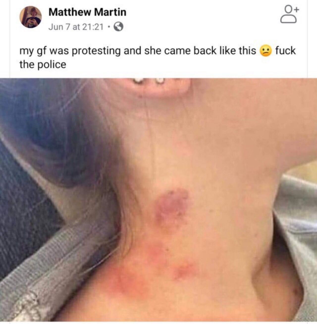Police bruta... wait...
