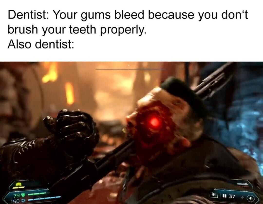 Looks a little painful buddy