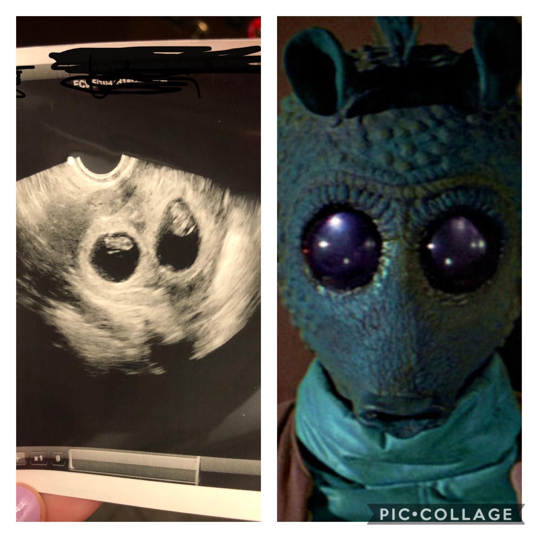My wife’s ultrasound reminded me of something...